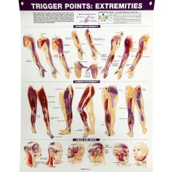 Trigger Points: Extremities Chart