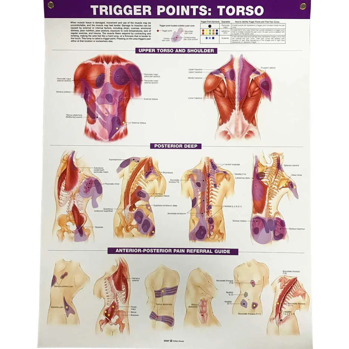 Trigger Points: Extremities Chart